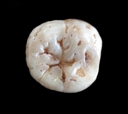 Neanderthaltoothpicture