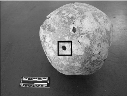 Acemhöyük trephination from the posterior view